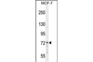 Western blot analysis in MCF-7 cell line lysates (35ug/lane). (MED25 antibody  (N-Term))