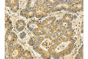 anti-Arrestin Domain Containing 2 (ARRDC2) (C-Term) antibody