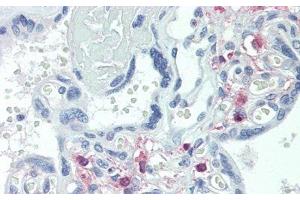 Immunohistochemistry (IHC) image for anti-Transient Receptor Potential Cation Channel, Subfamily C, Member 6 (TRPC6) (AA 1-192) antibody (ABIN7441304)