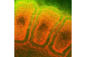 Immunohistochemistry analysis using Mouse Anti-Hsp27 Monoclonal Antibody, Clone 8A7 . (HSP27 antibody  (PE))