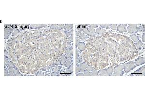Changes in adrenal glands and pancreas in acNTS injured mice. (Insulin antibody  (AA 46-59))