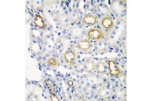 Immunohistochemistry of paraffin-embedded rat kidney using RARRES2 antibody (ABIN5974187) at dilution of 1/200 (40x lens). (Chemerin antibody)