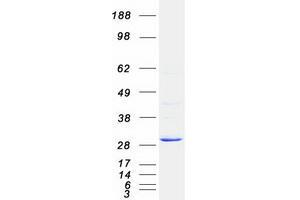 Validation with Western Blot (PNMT Protein (Myc-DYKDDDDK Tag))