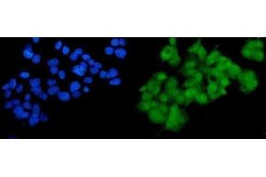 IF analysis of SOX18 using anti-SOX18 antibody (ABIN7602205).