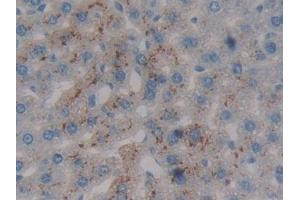 #VALUE! (Prothrombin Fragment 1+2 antibody  (AA 44-324))