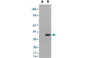 HEK293 overexpressing SNX16 and probed with SNX16 polyclonal antibody  (mock transfection in first lane), tested by Origene.