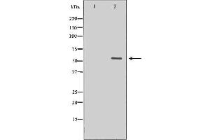 Western blot analysis of extracts of human heart tissue, using MYOC antibody. (MYOC antibody  (Internal Region))