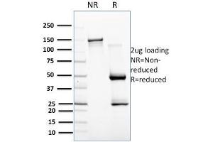 SDS-PAGE Analysis Purified CD257 Mouse Monoclonal Antibody (C257/1638).