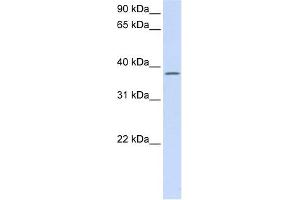 C21ORF91 antibody used at 1 ug/ml to detect target protein. (C21orf91 antibody  (Middle Region))