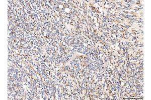 IHC analysis of CD93 using anti-CD93 antibody (ABIN7602865). (CD93 antibody  (C-Term))