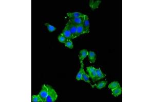 Immunofluorescent analysis of HepG2 cells using ABIN7173569 at dilution of 1:100 and Alexa Fluor 488-congugated AffiniPure Goat Anti-Rabbit IgG(H+L) (TNNC1 antibody  (AA 11-149))