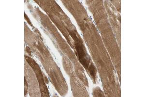 Immunohistochemical staining (Formalin-fixed paraffin-embedded sections) of human skeletal muscle with JPH1 polyclonal antibody  shows strong cytoplasmic positivity in myocytes. (Junctophilin 1 antibody  (AA 387-512))