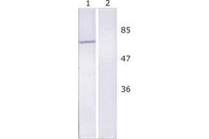 WB analysis of Huh-7 cell line expressing NS5B protein. (HCV 1b NS5B antibody  (AA 92-105))