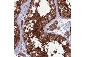 Immunohistochemical staining of human testis with ZC3HAV1 polyclonal antibody  shows strong cytoplasmic positivity in cells in seminiferus ducts at 1:20-1:50 dilution. (ZC3HAV1 antibody)