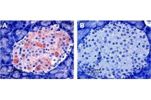 Expression of Kir6. (KCNJ11 antibody  (C-Term, Intracellular))