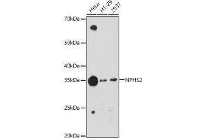 Western blot analysis of extracts of various cell lines, using NPHS2 antibody (ABIN1680543, ABIN7101468, ABIN7101469 and ABIN7101470) at 1:1000 dilution. (Podocin antibody)