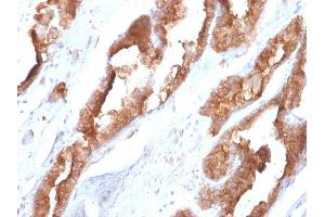 Formalin-fixed, paraffin-embedded human Prostate stained with HSP27 Mouse Monoclonal Antibody (CPTC-HSPB1-2). (HSP27 antibody)