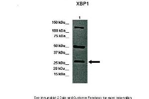 Lanes:   Lane 1: 40ug whole canine retina  Primary Antibody Dilution:   1:1000  Secondary Antibody:   Anti-rabbit-HRP  Secondary Antibody Dilution:   1:5000  Gene Name:   XBP1 a  Submitted by:   Dr. (XBP1 antibody  (C-Term))