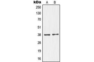 Western blot analysis of NKX2-1 expression in MAD109 (A), HeLa (B), SP2/0 (C) whole cell lysates. (NKX2-1 antibody  (N-Term))