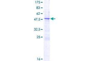 C1QTNF3 Protein (AA 1-246) (GST tag)