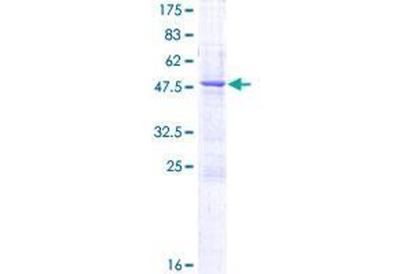 C1QTNF3 Protein (AA 1-246) (GST tag)