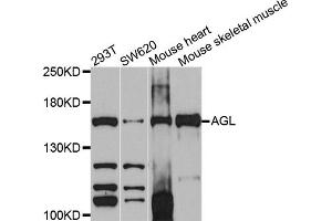 Western blot analysis of extracts of various cell lines, using AGL antibody (ABIN4902856) at 1:1000 dilution.
