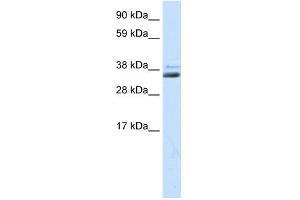 WB Suggested Anti-SFRP1 Antibody Titration:  0. (SFRP1 antibody  (Middle Region))