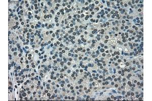 Immunohistochemical staining of paraffin-embedded Ovary tissue using anti-NEK6mouse monoclonal antibody. (NEK6 antibody)