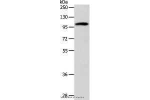 Western blot analysis of 293T cell, using ADCY1 Polyclonal Antibody at dilution of 1:1000 (ADCY1 antibody)