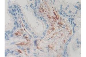 DAB staining on IHC-P; Samples: Human Prostate Tissue (PRNP antibody  (AA 23-230))