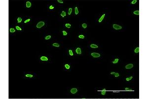 Immunofluorescence of monoclonal antibody to HNRNPA2B1 on HeLa cell. (HNRNPA2B1 antibody  (AA 1-249))