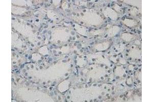 Immunohistochemical staining of formalin-fixed paraffin-embedded human kidney tissue showing cytoplasmic and nuclear staining with PAWR polyclonal antibody  at 1 : 100 dilution.