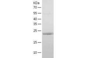 MED7 Protein (AA 1-233) (His tag)