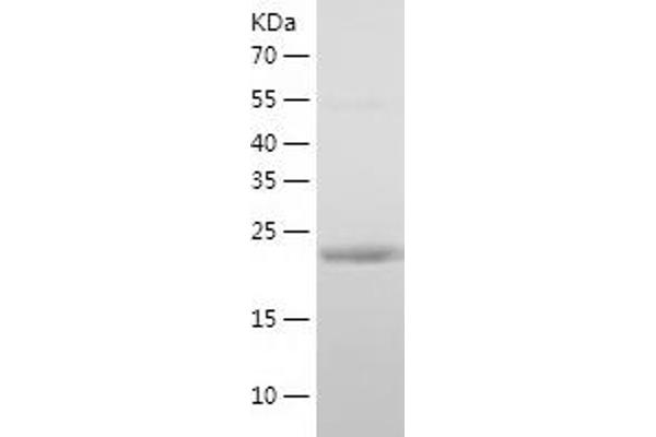 MED7 Protein (AA 1-233) (His tag)