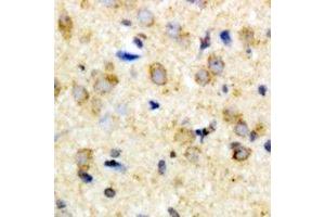 Immunohistochemical analysis of FIH-1 staining in rat brain formalin fixed paraffin embedded tissue section. (HIF1AN antibody)