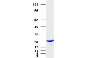 Validation with Western Blot (PSME1 Protein (Transcript Variant 1) (Myc-DYKDDDDK Tag))