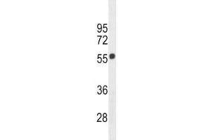 Cannabinoid Receptor 1 antibody western blot analysis in 293 lysate. (CNR1 antibody  (AA 161-187))