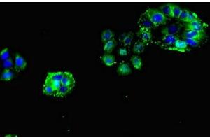 Immunofluorescence (IF) image for anti-Nicotinic Acetylcholine Receptor beta (CHRNB1) (AA 24-244) antibody (ABIN7142959)