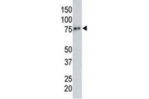 Anti-HA tag antibody testing a tagged recombinant protein. (HA-Tag antibody)