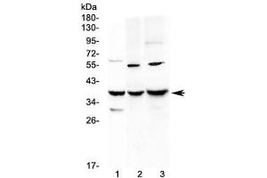 Western blot testing of 1) rat liver, 2) mouse Neuro-2a and 3) mouse HEPA1-6 lysate with IGFBP2 antibody at 0. (IGFBP2 antibody  (AA 35-304))
