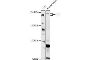 Western blot analysis of extracts of various cell lines, using TSC2 antibody (ABIN1683176, ABIN5663676 and ABIN7101314) at 1:1000 dilution. (Tuberin antibody)
