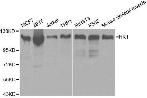 Hexokinase 1 anticorps  (AA 20-300)