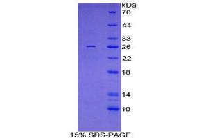 SDS-PAGE (SDS) image for FK506 Binding Protein 8, 38kDa (FKBP8) (AA 110-329) protein (His tag) (ABIN2121087)