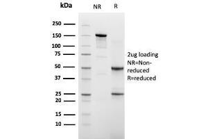 SDS-PAGE Analysis of Purified Cadherin 16 Mouse Monoclonal Antibody (CDH16/2448). (Cadherin-16 antibody  (AA 371-507))