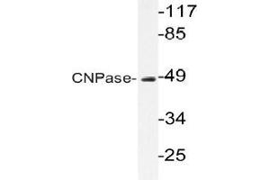 Western blot (WB) analysis of CNPase antibody in extracts from HUVEC cells. (Cnpase antibody)