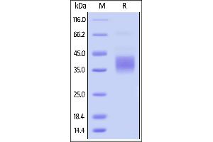Biotinylated Mouse CD32b, Avitag,His Tag (SPR & BLI verified) on  under reducing (R) condition.