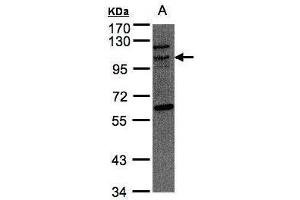 WB Image Sample(30 μg of whole cell lysate) A:Raji, 7. (TAO Kinase 3 antibody)