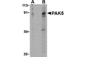 Western Blotting (WB) image for anti-P21 Protein (Cdc42/Rac)-Activated Kinase 7 (PAK7) (Middle Region) antibody (ABIN1031031) (PAK7 antibody  (Middle Region))