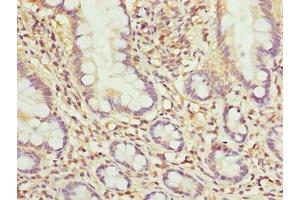 Immunohistochemistry of paraffin-embedded human small intestine tissue using ABIN7142439 at dilution of 1:100 (MRPL51 antibody  (AA 32-128))
