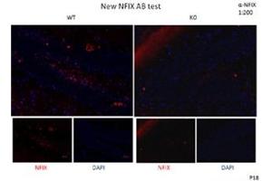 DG of Hippocampus   Dilution:  1:200 (NFIX antibody  (Middle Region))